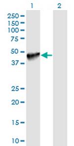 PDCD1LG2 Antibody in Western Blot (WB)