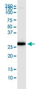 PDCD1LG2 Antibody in Western Blot (WB)