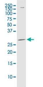 PDCD1LG2 Antibody in Western Blot (WB)