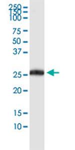 PDCD1LG2 Antibody in Western Blot (WB)