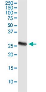 PDCD1LG2 Antibody in Western Blot (WB)