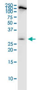 PDCD1LG2 Antibody in Western Blot (WB)