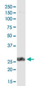 PDCD1LG2 Antibody in Western Blot (WB)