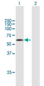 TSEN2 Antibody in Western Blot (WB)