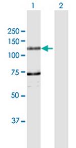 DDHD1 Antibody in Western Blot (WB)