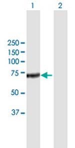 CFHL5 Antibody in Western Blot (WB)