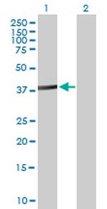 ACTL8 Antibody in Western Blot (WB)