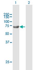 ACSBG2 Antibody in Western Blot (WB)