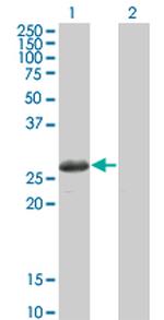 TSSK3 Antibody in Western Blot (WB)