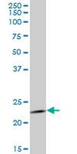 RAB1B Antibody in Western Blot (WB)