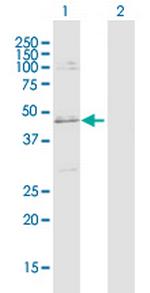 SLC25A31 Antibody in Western Blot (WB)