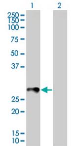 RAB33B Antibody in Western Blot (WB)