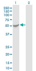 KATNAL2 Antibody in Western Blot (WB)