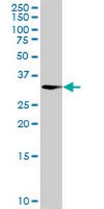 AKR1CL2 Antibody in Western Blot (WB)