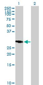 RASSF5 Antibody in Western Blot (WB)