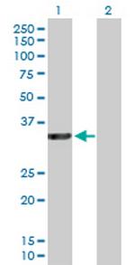 RASSF5 Antibody in Western Blot (WB)