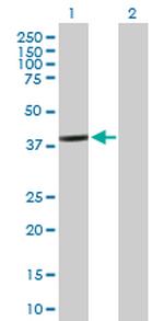 BCL2L12 Antibody in Western Blot (WB)