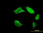 FERMT3 Antibody in Immunocytochemistry (ICC/IF)