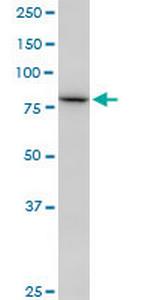 SETDB2 Antibody in Western Blot (WB)