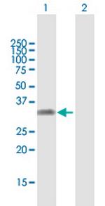 KLF16 Antibody in Western Blot (WB)