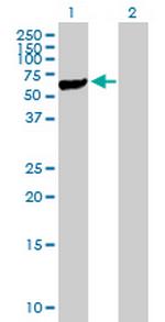 STK40 Antibody in Western Blot (WB)