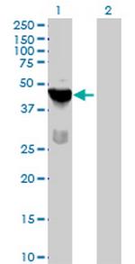 TSSK1B Antibody in Western Blot (WB)