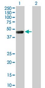 TSSK1B Antibody in Western Blot (WB)