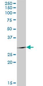 TSSK6 Antibody in Western Blot (WB)