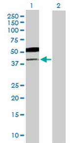 B3GNT5 Antibody in Western Blot (WB)