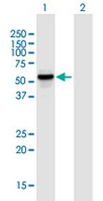 KATNAL1 Antibody in Western Blot (WB)