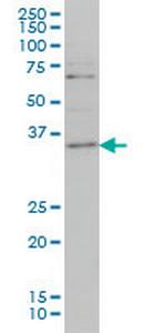 ZIC4 Antibody in Western Blot (WB)