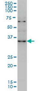 ZIC4 Antibody in Western Blot (WB)