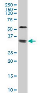 ZIC4 Antibody in Western Blot (WB)