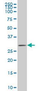 ZIC4 Antibody in Western Blot (WB)