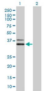 PCGF6 Antibody in Western Blot (WB)