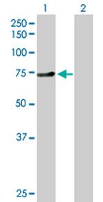 ZNF394 Antibody in Western Blot (WB)