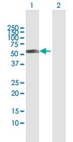 MYST1 Antibody in Western Blot (WB)