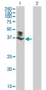 FLJ23356 Antibody in Western Blot (WB)