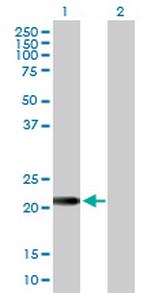 EFCAB2 Antibody in Western Blot (WB)