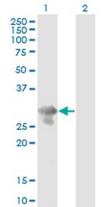 PCGF5 Antibody in Western Blot (WB)