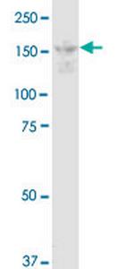 DOT1L Antibody in Western Blot (WB)