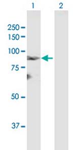 LZTS2 Antibody in Western Blot (WB)