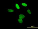 L3MBTL3 Antibody in Immunocytochemistry (ICC/IF)