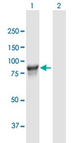 L3MBTL3 Antibody in Western Blot (WB)