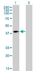 ARPM1 Antibody in Western Blot (WB)