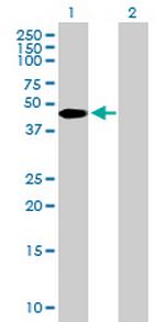 ZBTB37 Antibody in Western Blot (WB)