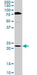 TRIM55 Antibody in Western Blot (WB)