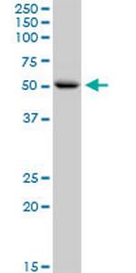 CNDP1 Antibody in Western Blot (WB)