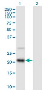 RAX2 Antibody in Western Blot (WB)