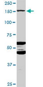 ABCC11 Antibody in Western Blot (WB)